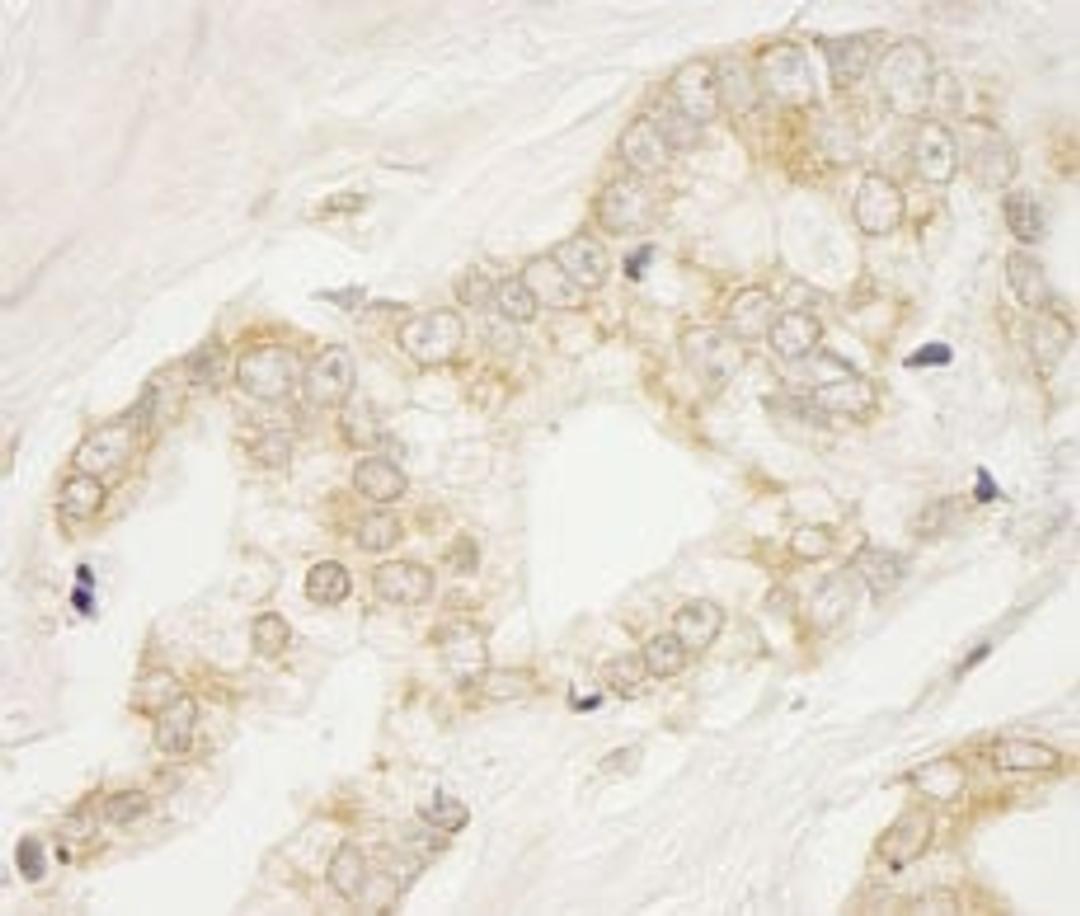 Detection of human BIG1/ARFGEF1 by immunohistochemistry.