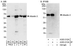 Detection of human and mouse Atlastin-3 by western blot (h and m) and immunoprecipitation (h).