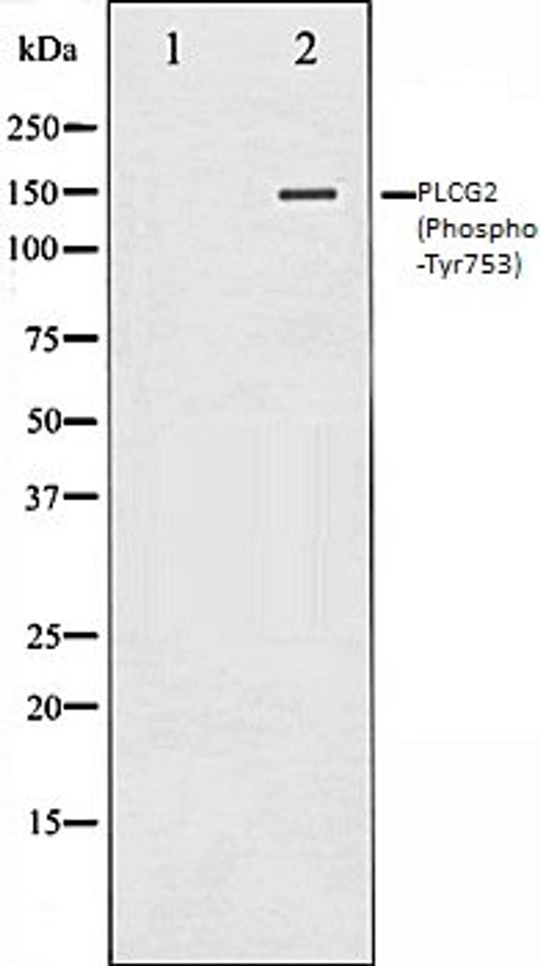 Western blot analysis of HepG2 whole cell lysates using PLCG2 (Phospho-Tyr753) antibody, The lane on the left is treated with the antigen-specific peptide.