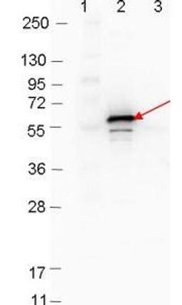 Western blot analysis of Molecular weight markers MBP-DbpB fusion protein (arrow; expected MW = 60.3 kDa) using DbpB antibody