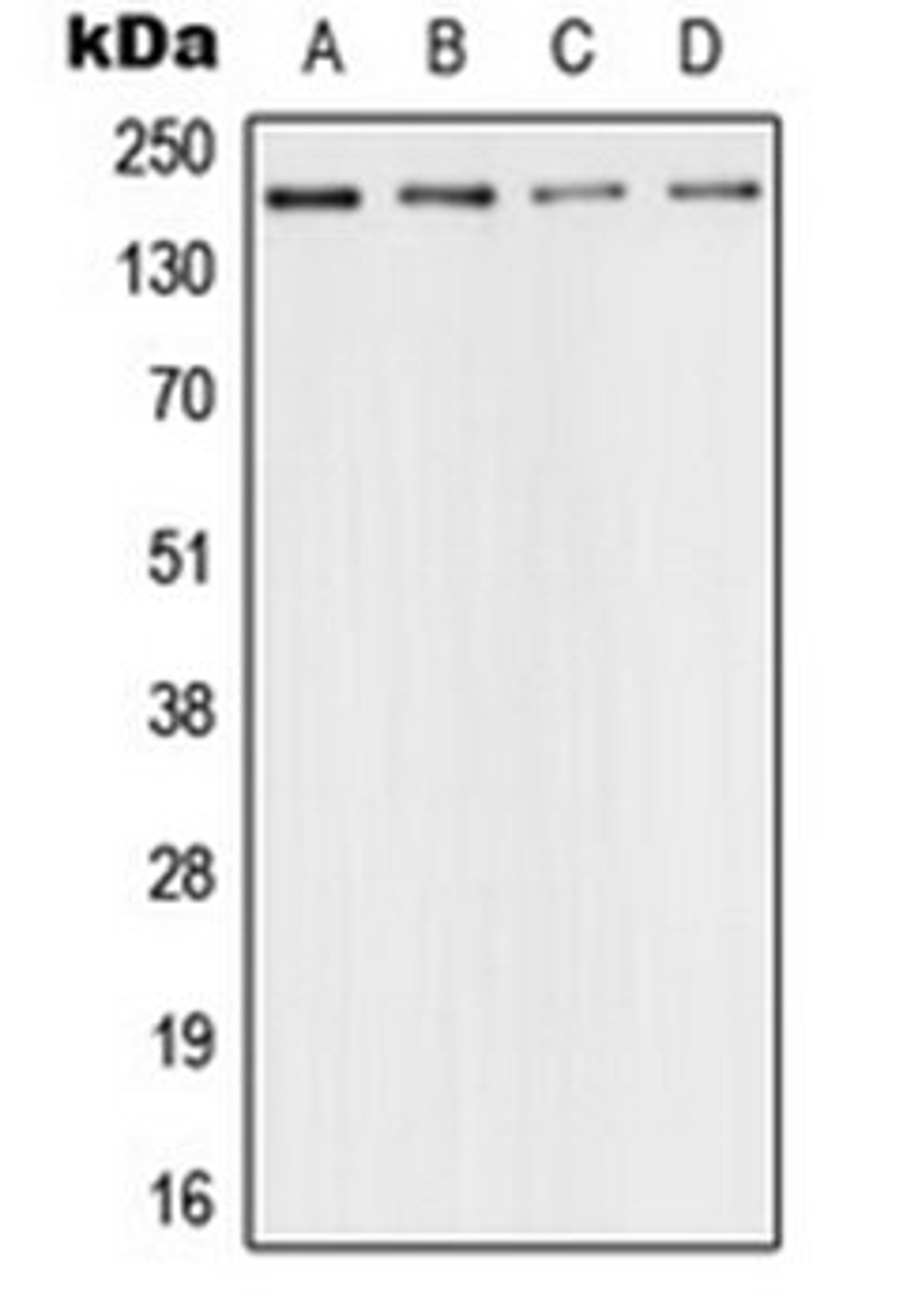 Western blot analysis of HeLa (Lane 1), SP2/0 (Lane 2), PC12 (Lane 3), rat kidney (Lane 4) whole cell lysates using 53BP1 antibody