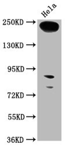 Western Blot. Positive WB detected in: Hela whole cell lysate. All lanes: RTTN antibody at 1:1000. Secondary. Goat polyclonal to rabbit IgG at 1/50000 dilution. Predicted band size: 249, 68, 246, 99 kDa. Observed band size: 249 kDa. 