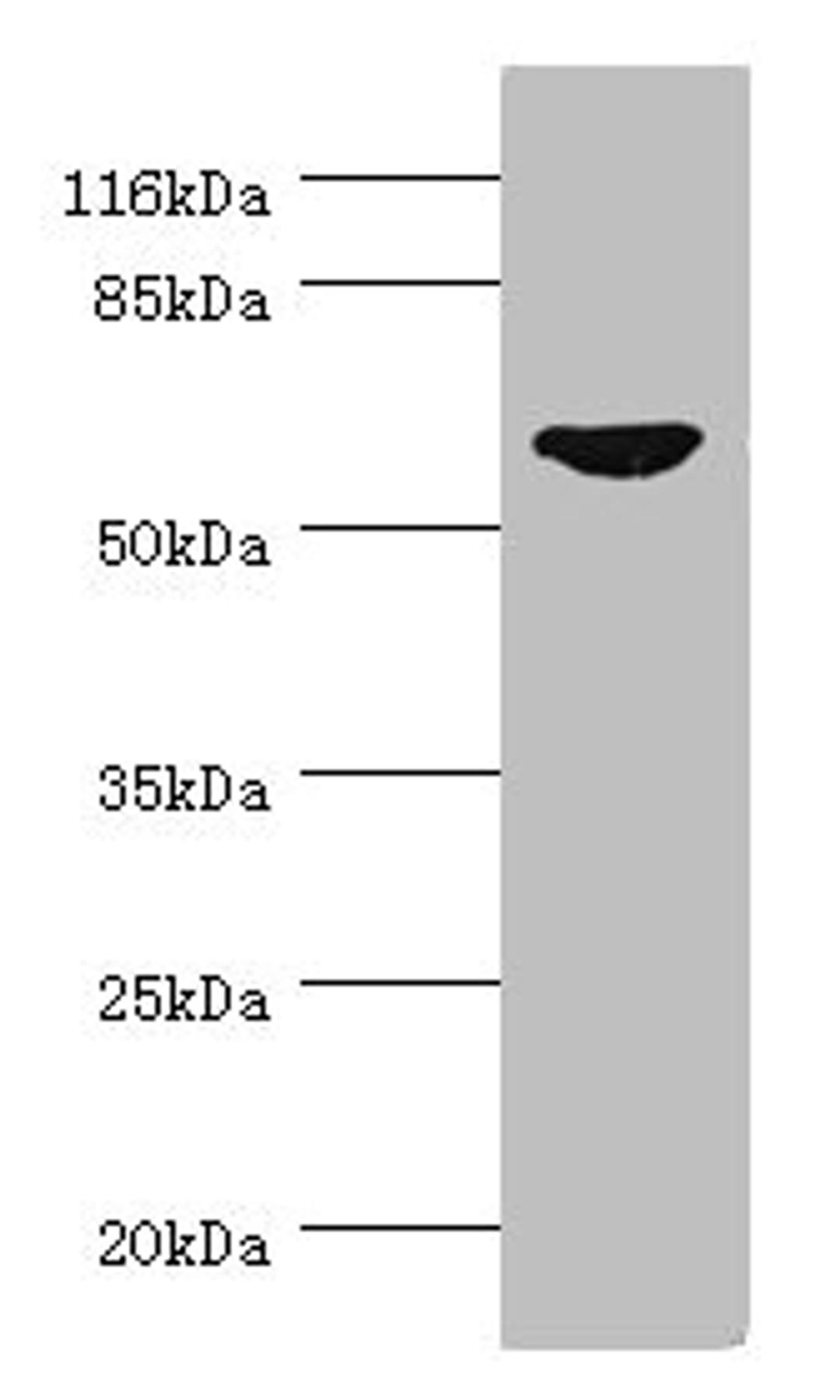 Western blot. All lanes: CDC7 antibody at 0.95ug/ml + SY-5Y whole cell lysate. Secondary. Goat polyclonal to rabbit IgG at 1/10000 dilution. Predicted band size: 64 kDa. Observed band size: 64 kDa.