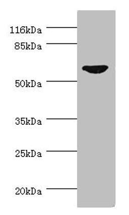 Western blot. All lanes: CDC7 antibody at 0.95ug/ml + SY-5Y whole cell lysate. Secondary. Goat polyclonal to rabbit IgG at 1/10000 dilution. Predicted band size: 64 kDa. Observed band size: 64 kDa.