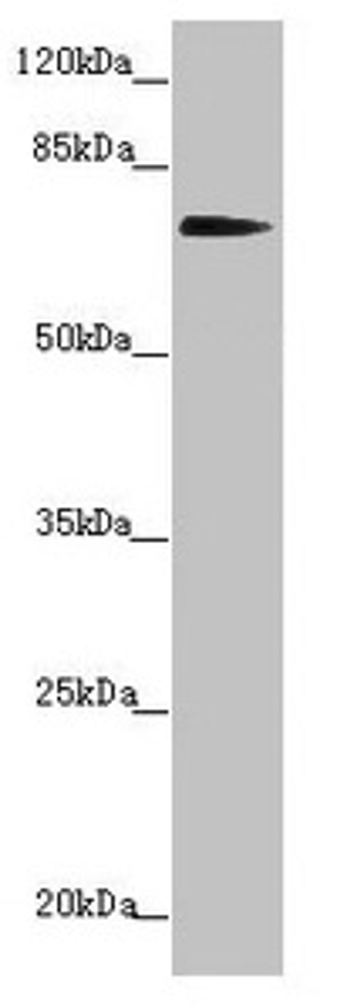Western blot. All lanes: KIZ antibody at 2.41µg/ml + Hela whole cell lysate. Secondary. Goat polyclonal to rabbit IgG at 1/10000 dilution. Predicted band size: 76, 63, 70, 74, 60 kDa. Observed band size: 76 kDa