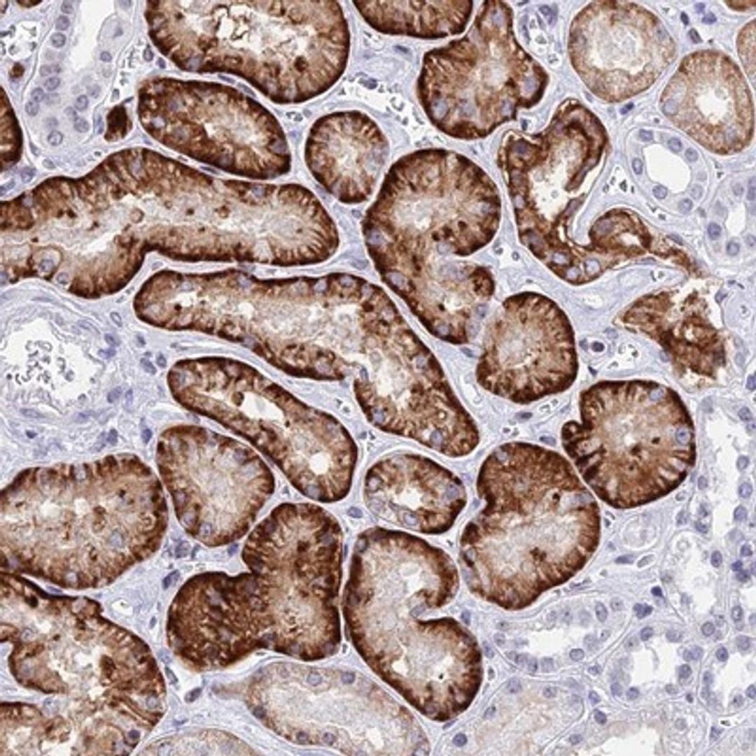 Immunohistochemistry-Paraffin: SLC22A8 Antibody [NBP1-92396] - Staining of human kidney shows strong cytoplasmic positivity in cells in tubules.