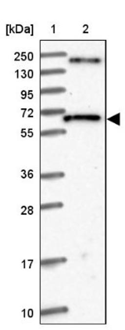 Western Blot: TM7SF3 Antibody [NBP1-90891] - Lane 1: Marker [kDa] 250, 130, 95, 72, 55, 36, 28, 17, 10<br/>Lane 2: Human cell line RT-4