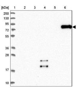 Western Blot: SCEL Antibody [NBP1-82138] - Lane 1: Marker [kDa] 250, 130, 95, 72, 55, 36, 28, 17, 10<br/>Lane 2: Human cell line RT-4<br/>Lane 3: Human cell line U-251MG sp<br/>Lane 4: Human plasma (IgG/HSA depleted)<br/>Lane 5: Human liver tissue<br/>Lane 6: Human tonsil tissue