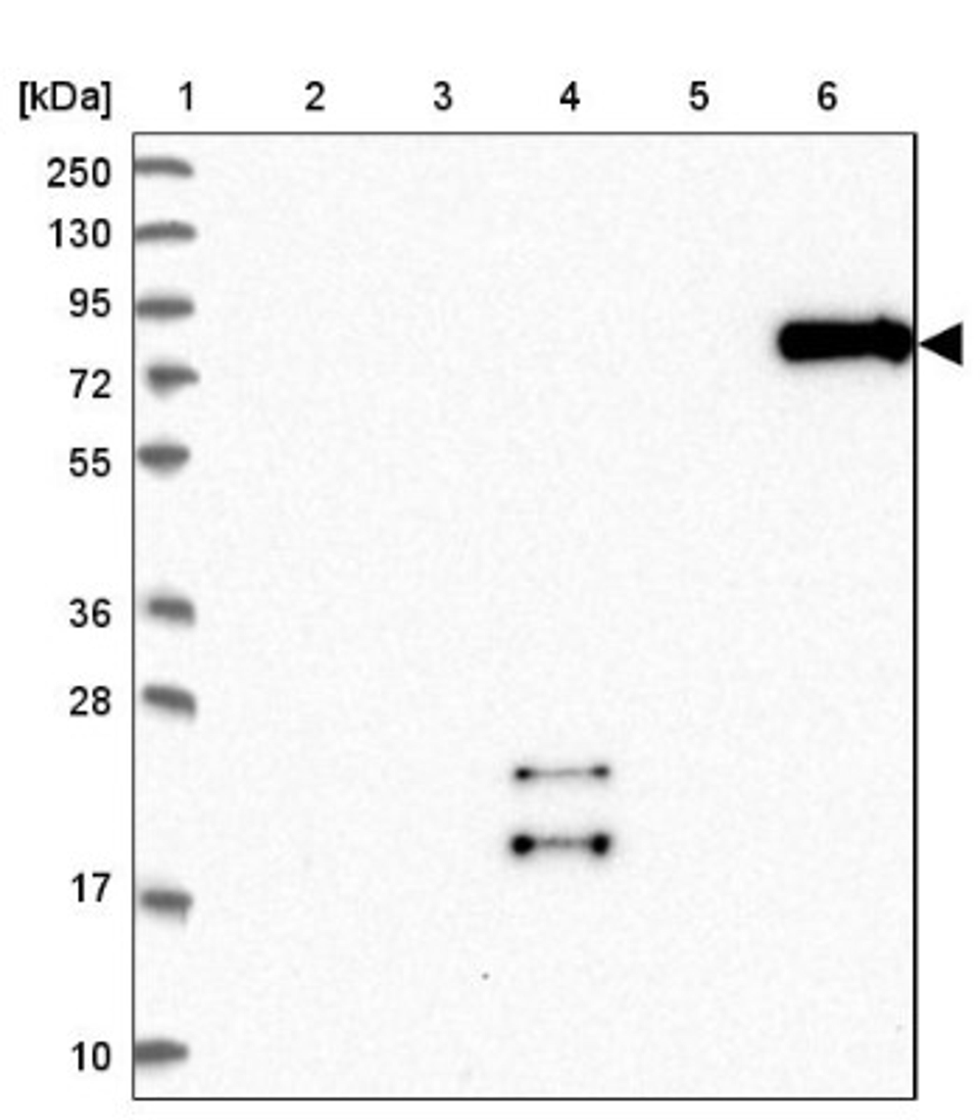 Western Blot: SCEL Antibody [NBP1-82138] - Lane 1: Marker [kDa] 250, 130, 95, 72, 55, 36, 28, 17, 10<br/>Lane 2: Human cell line RT-4<br/>Lane 3: Human cell line U-251MG sp<br/>Lane 4: Human plasma (IgG/HSA depleted)<br/>Lane 5: Human liver tissue<br/>Lane 6: Human tonsil tissue