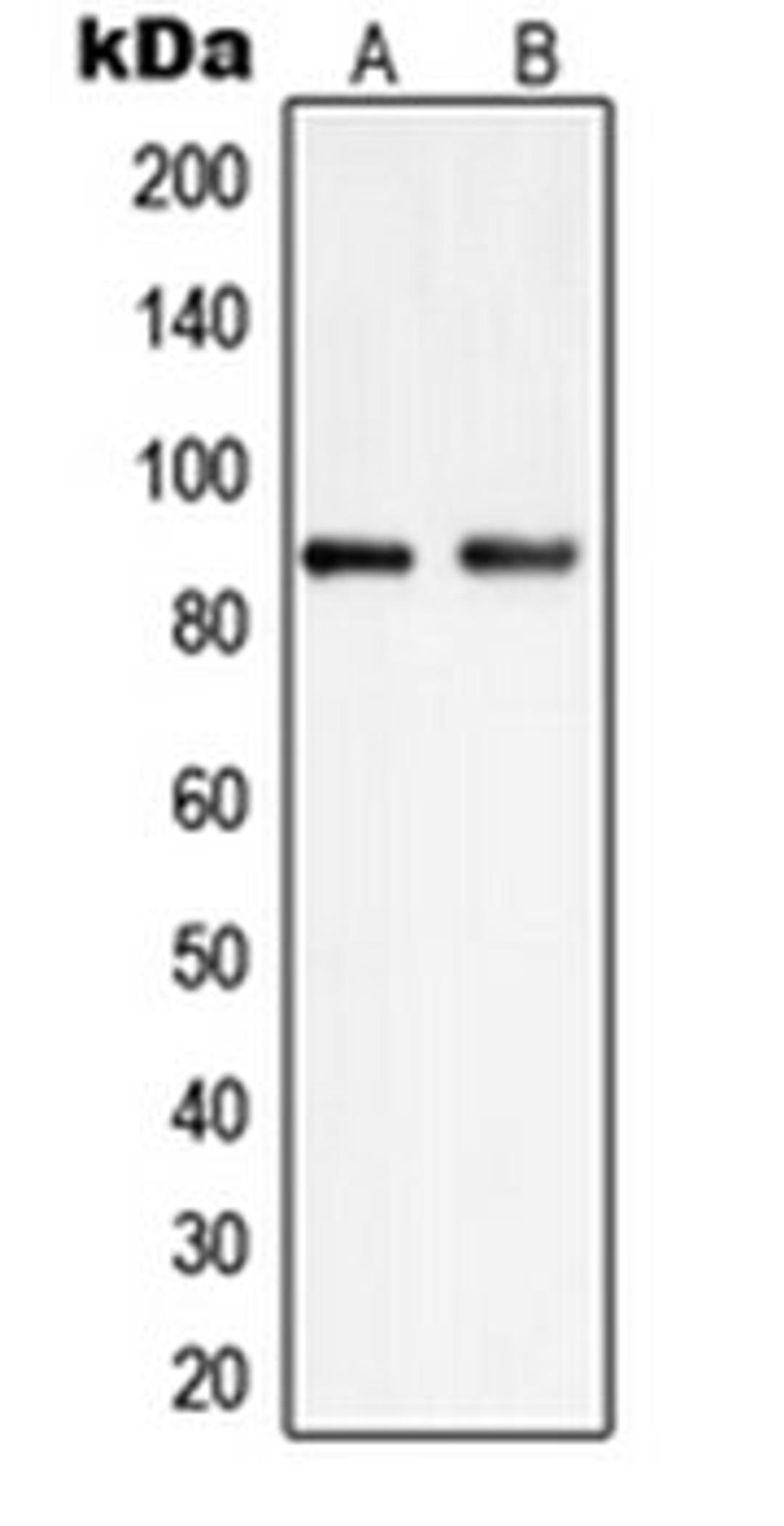 Western blot analysis of HEK293 (Lane 1), K562 (Lane 2) whole cell lysates using PIP5K1C antibody