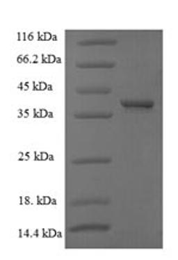 (Tris-Glycine gel) Discontinuous SDS-PAGE (reduced) with 5% enrichment gel and 15% separation gel.