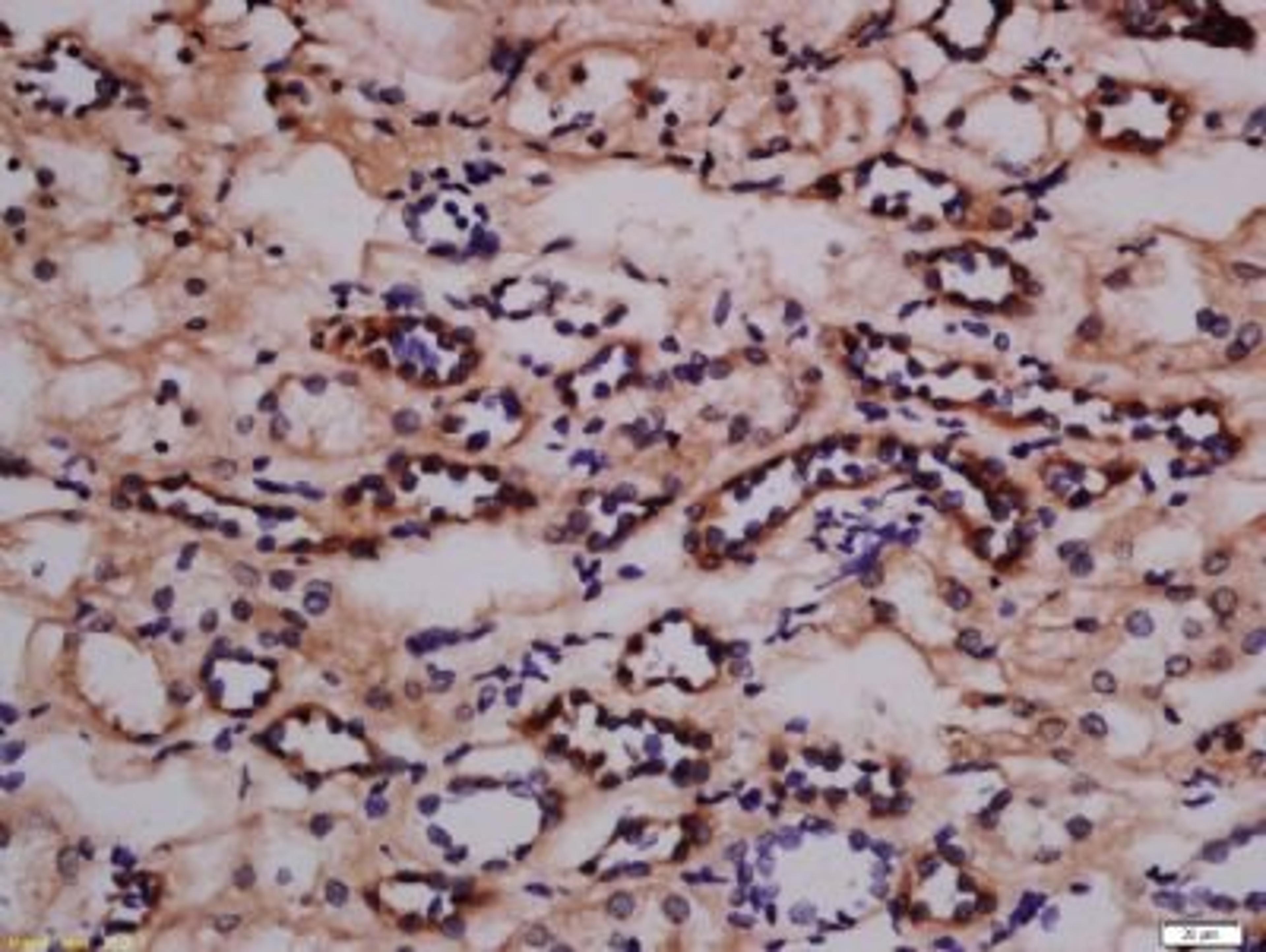 Immunohistochemical staining of human kidney tissue using Nephrin (phospho-Tyr1217) antibody.