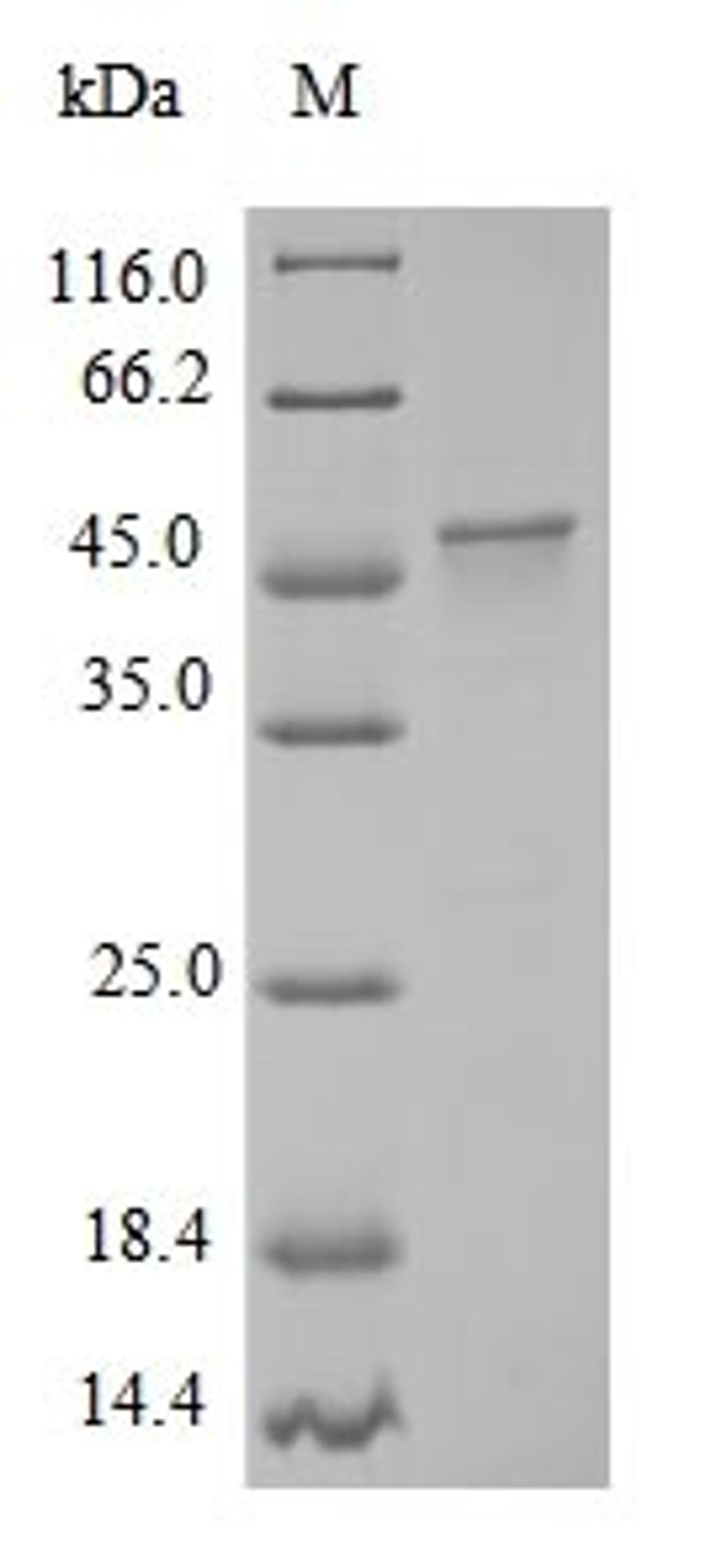 (Tris-Glycine gel) Discontinuous SDS-PAGE (reduced) with 5% enrichment gel and 15% separation gel.