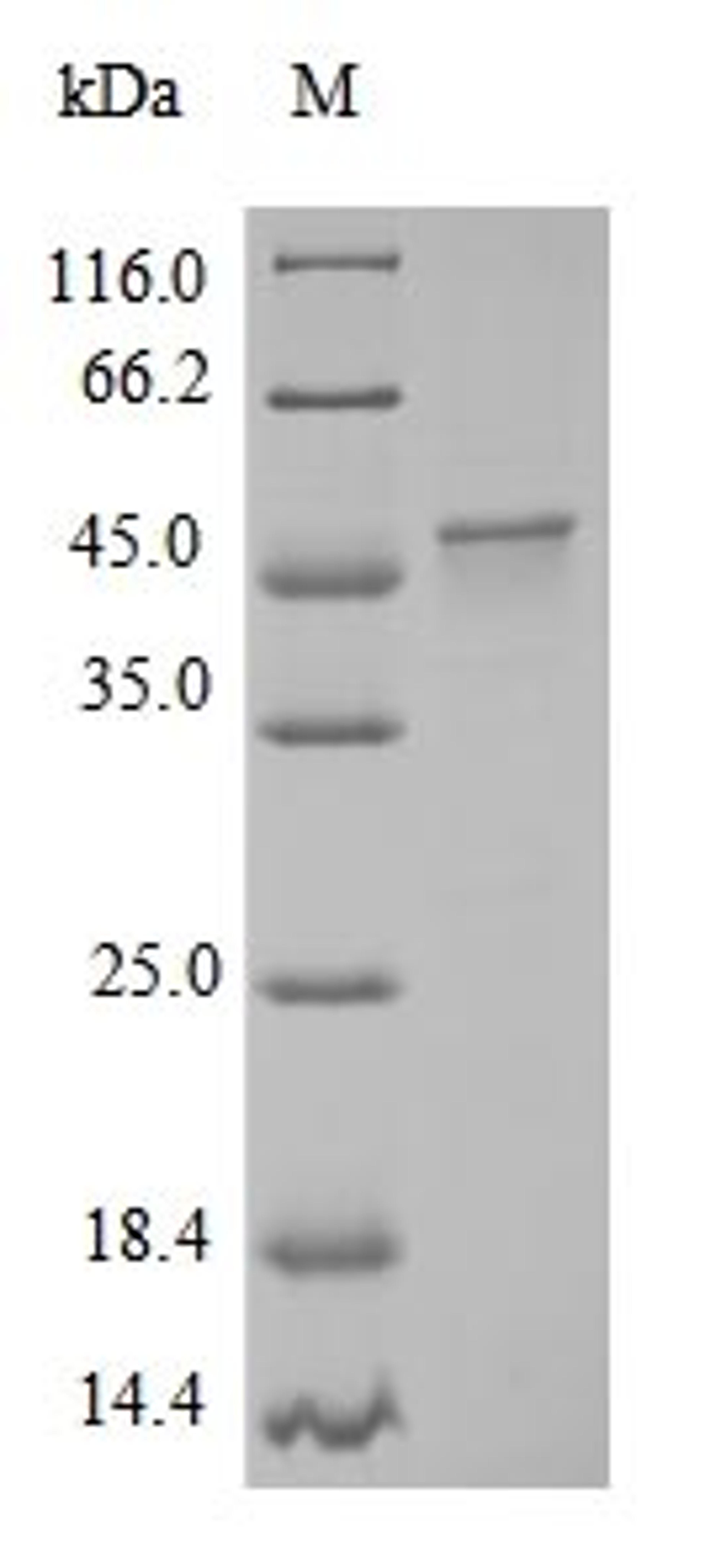(Tris-Glycine gel) Discontinuous SDS-PAGE (reduced) with 5% enrichment gel and 15% separation gel.