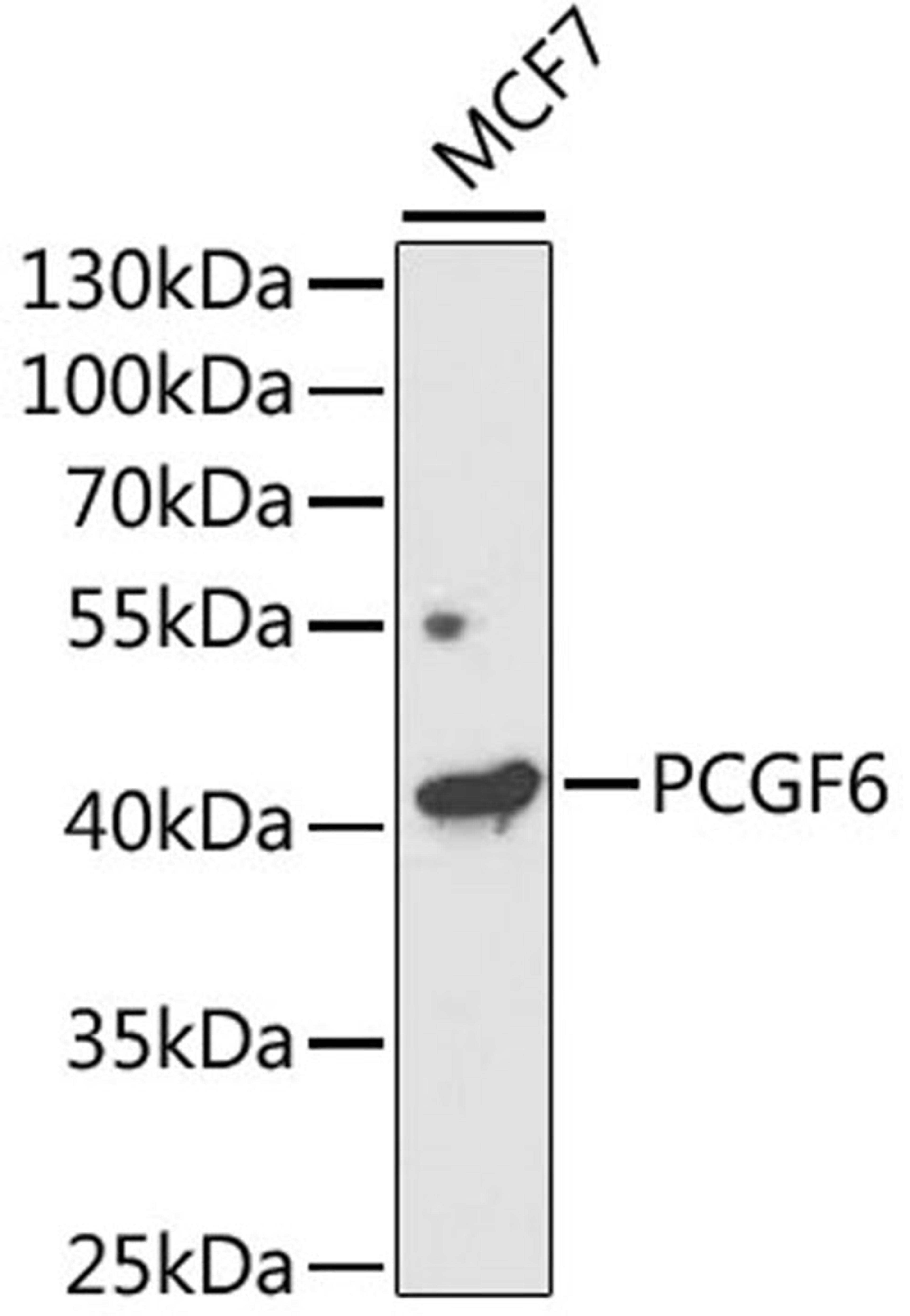 Western blot - PCGF6 antibody (A5760)