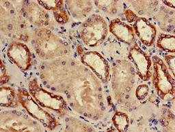 Immunohistochemistry of paraffin-embedded human kidney tissue using CSB-PA018914LA01HU at dilution of 1:100