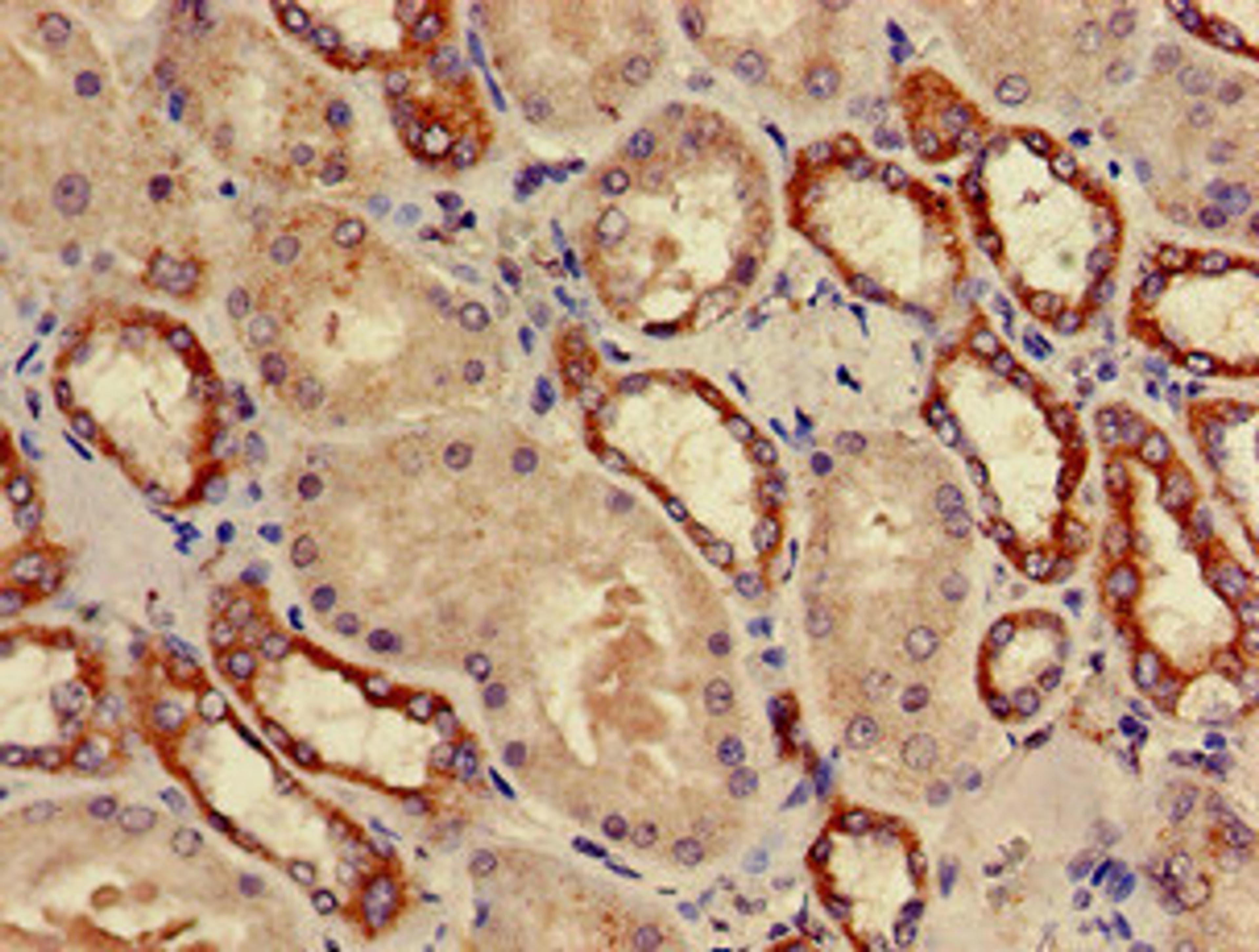 Immunohistochemistry of paraffin-embedded human kidney tissue using CSB-PA018914LA01HU at dilution of 1:100