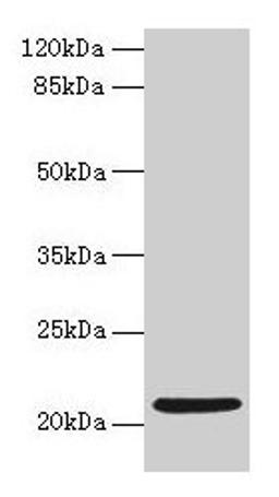 Western blot. All lanes: COPZ1 antibody at 1µg/ml + K562 whole cell lysate. Secondary. Goat polyclonal to rabbit IgG at 1/10000 dilution. Predicted band size: 21, 15, 18, 22, 19 kDa. Observed band size: 21 kDa