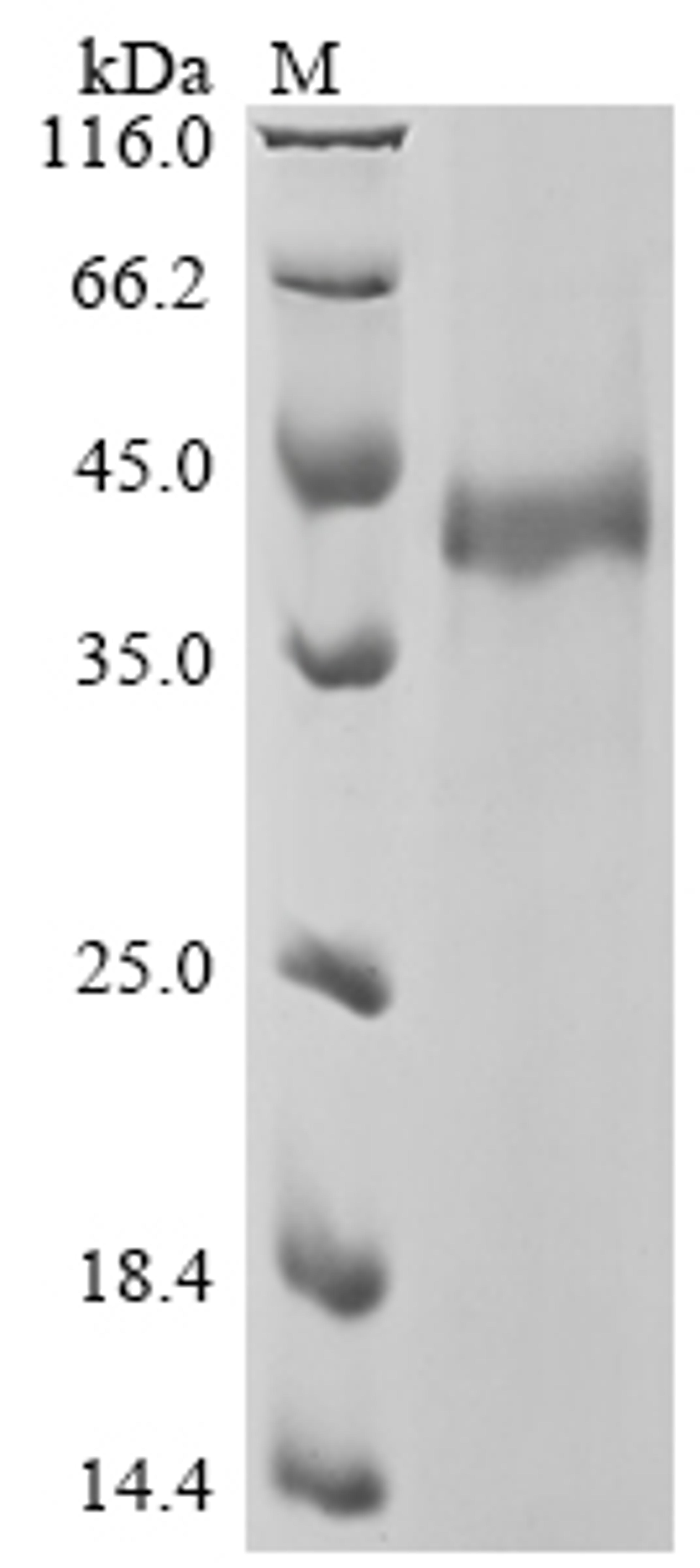 (Tris-Glycine gel) Discontinuous SDS-PAGE (reduced) with 5% enrichment gel and 15% separation gel.