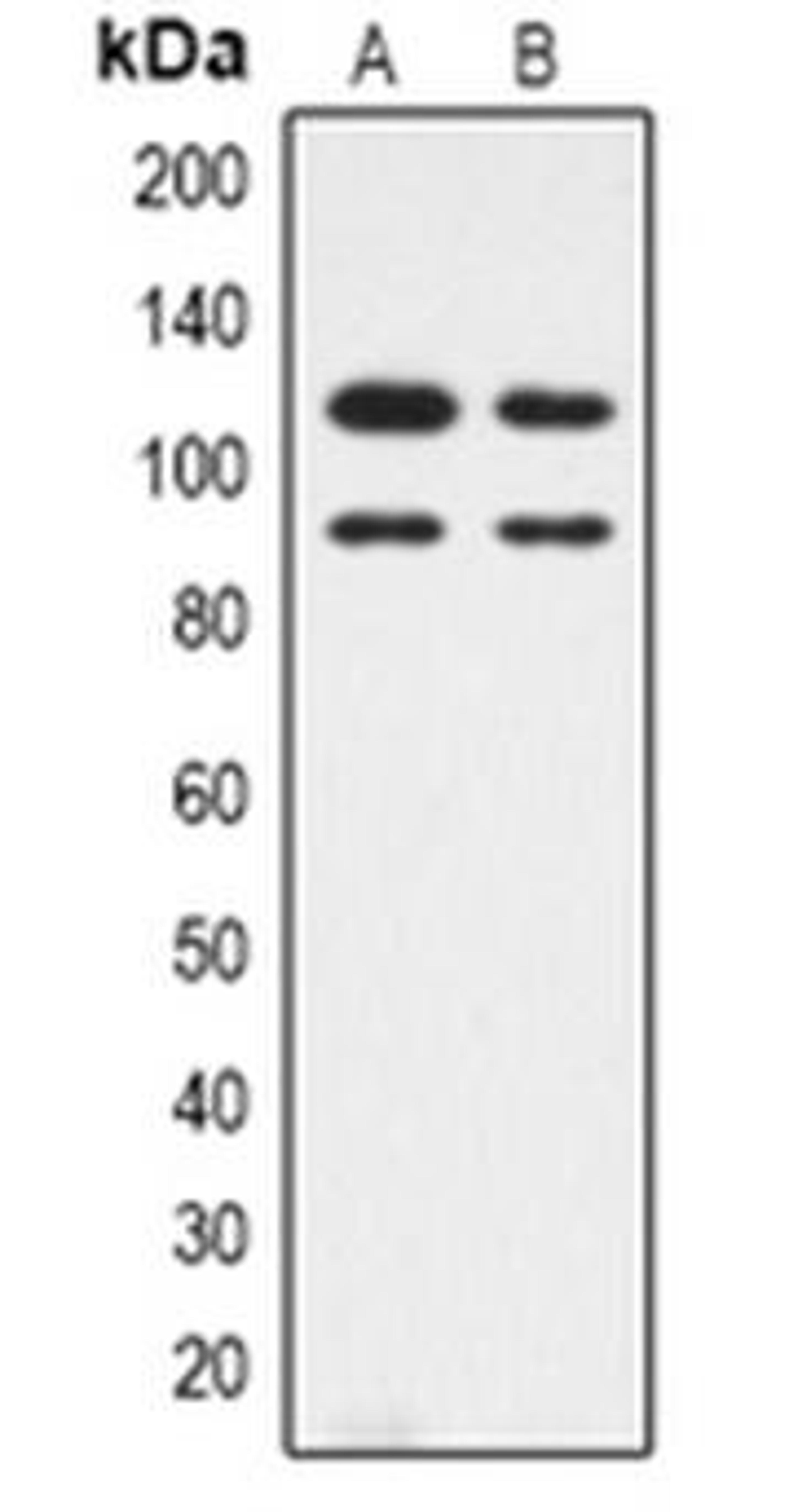 Western blot analysis of CDK11B expression in HepG2 (Lane 1), Hela (Lane 2) whole cell lysates using CDK11B antibody