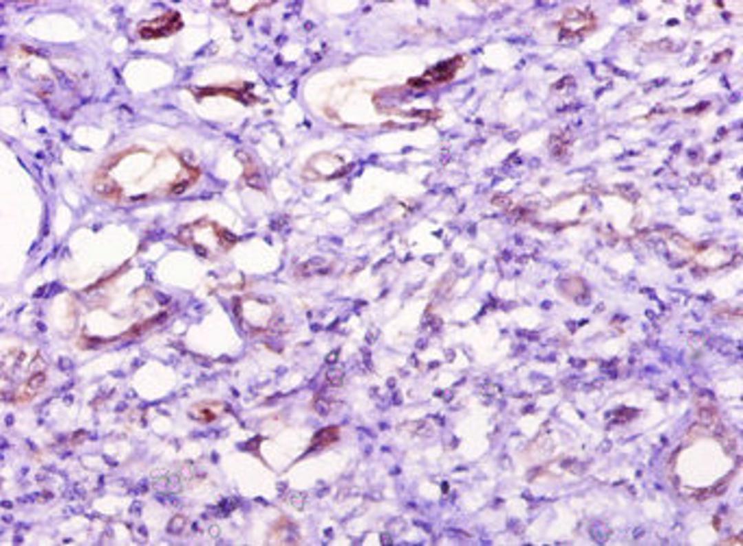 Immunohistochemistry of paraffin-embedded human kidney tissue using CSB-PA866304YA01HU at dilution of 1:10