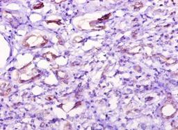 Immunohistochemistry of paraffin-embedded human kidney tissue using CSB-PA866304YA01HU at dilution of 1:10