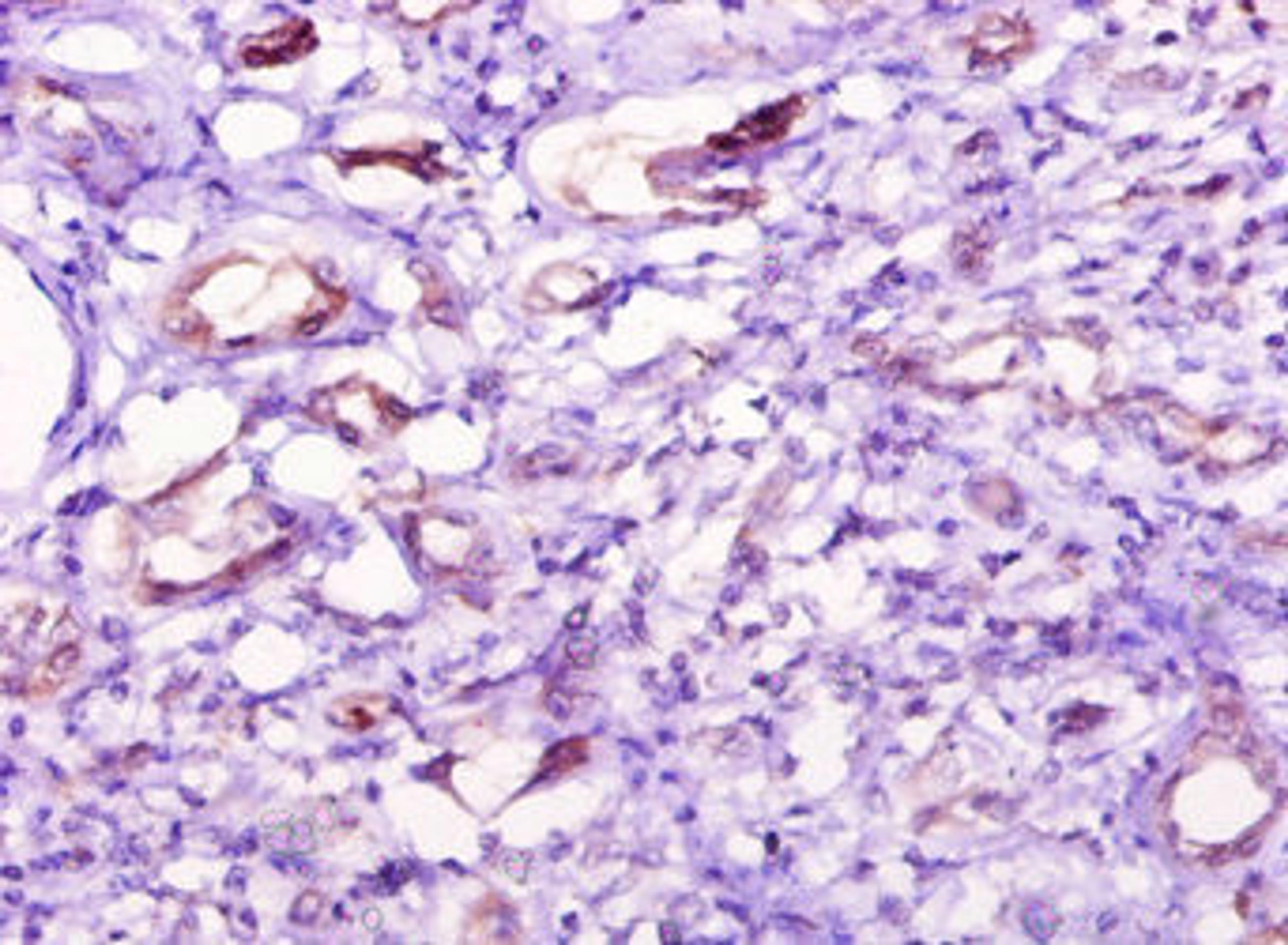 Immunohistochemistry of paraffin-embedded human kidney tissue using CSB-PA866304YA01HU at dilution of 1:10