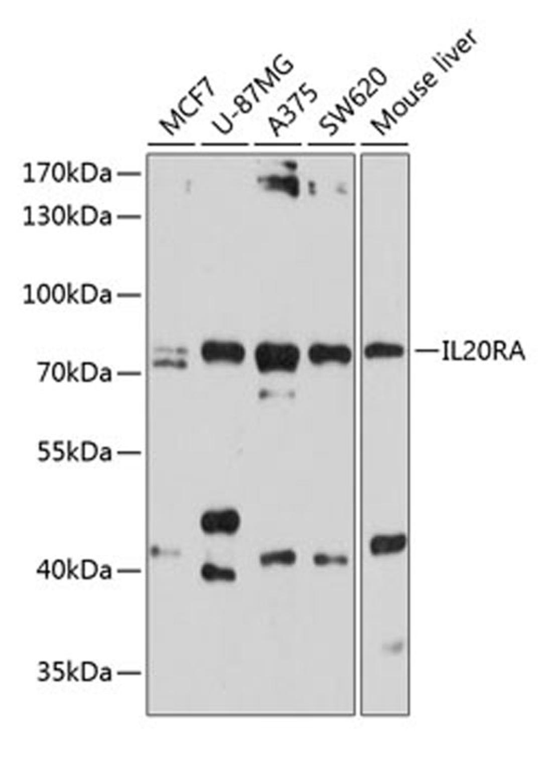 Western blot - IL20RA antibody (A10308)