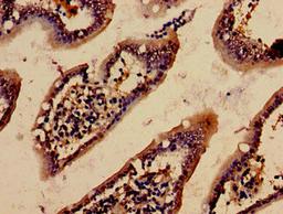 Immunohistochemistry analysis of human small intestine tissue using CSB-PA001207NJ01HU at dilution of 1:100
