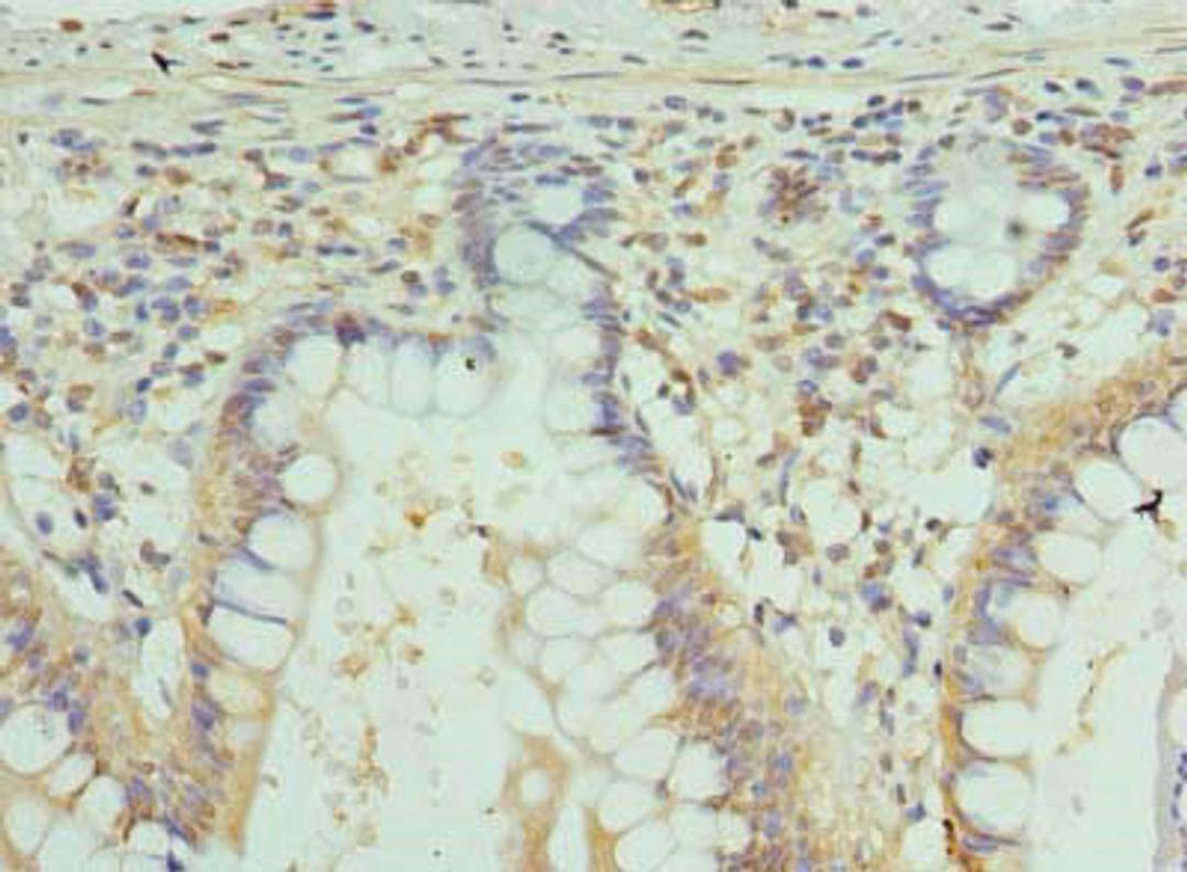 Immunohistochemistry of paraffin-embedded human small intestine tissue using CSB-PA009447LA01HU at dilution of 1:100