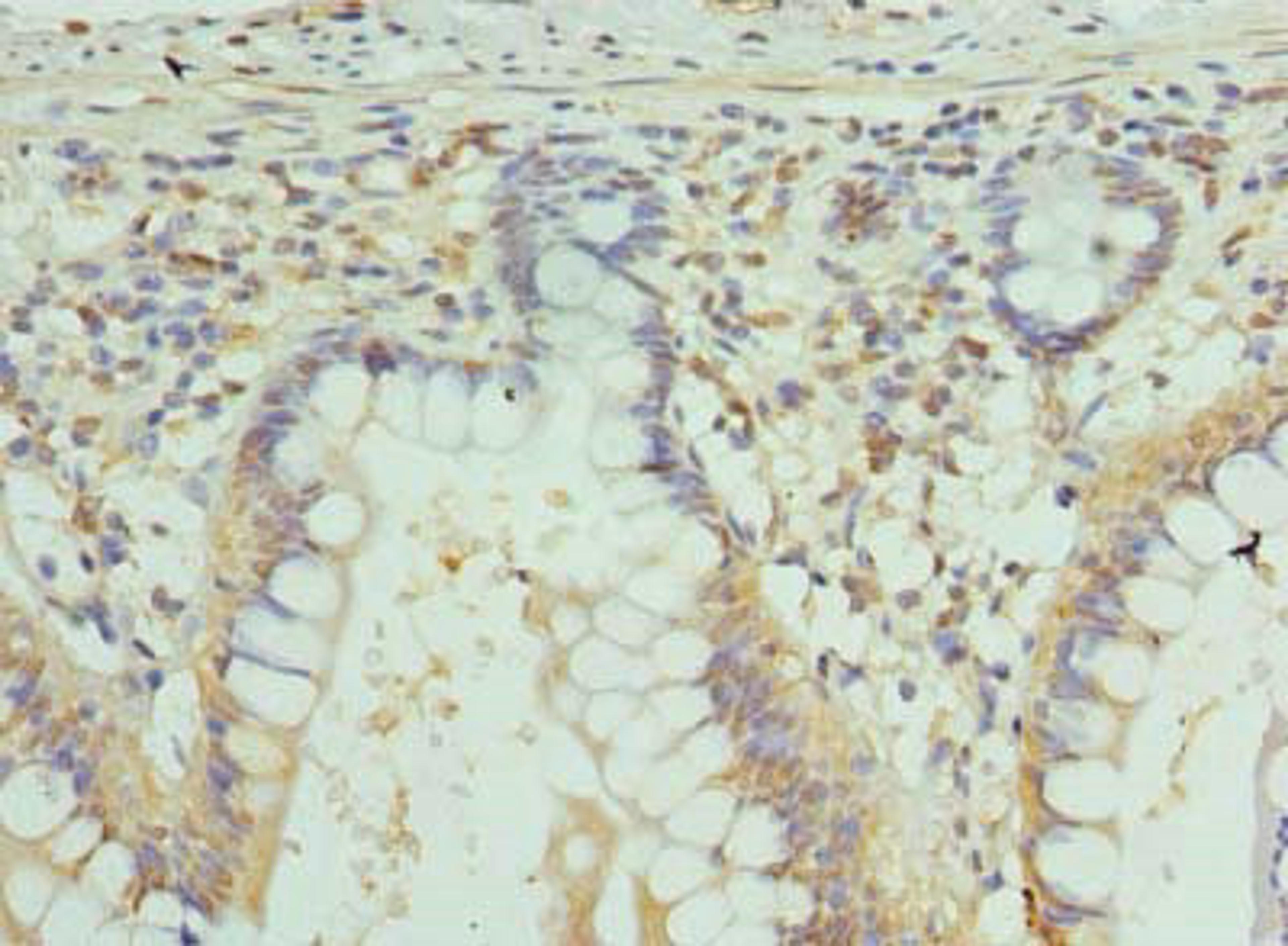 Immunohistochemistry of paraffin-embedded human small intestine tissue using CSB-PA009447LA01HU at dilution of 1:100