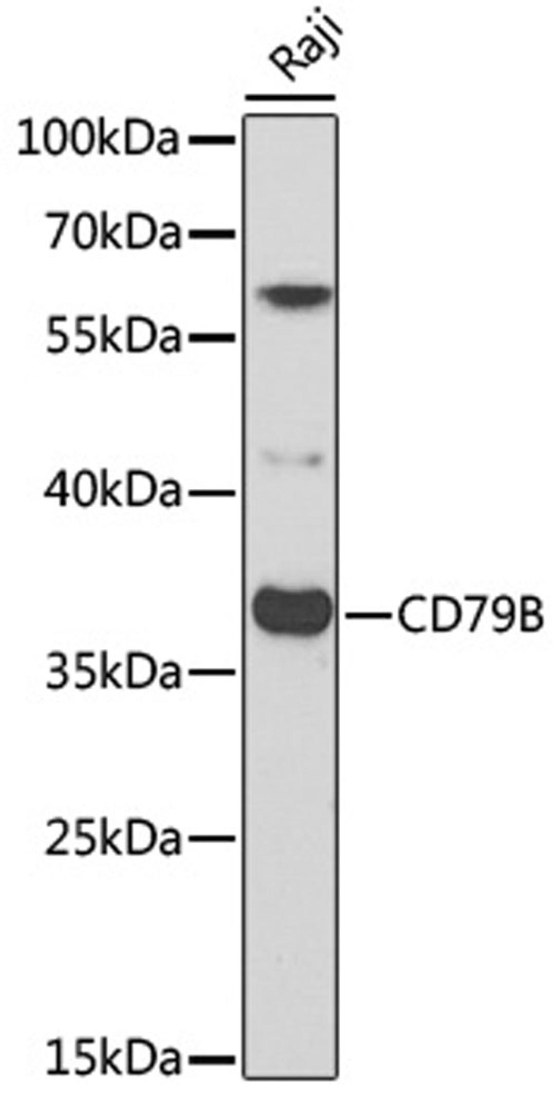 Western blot - CD79B antibody (A2033)