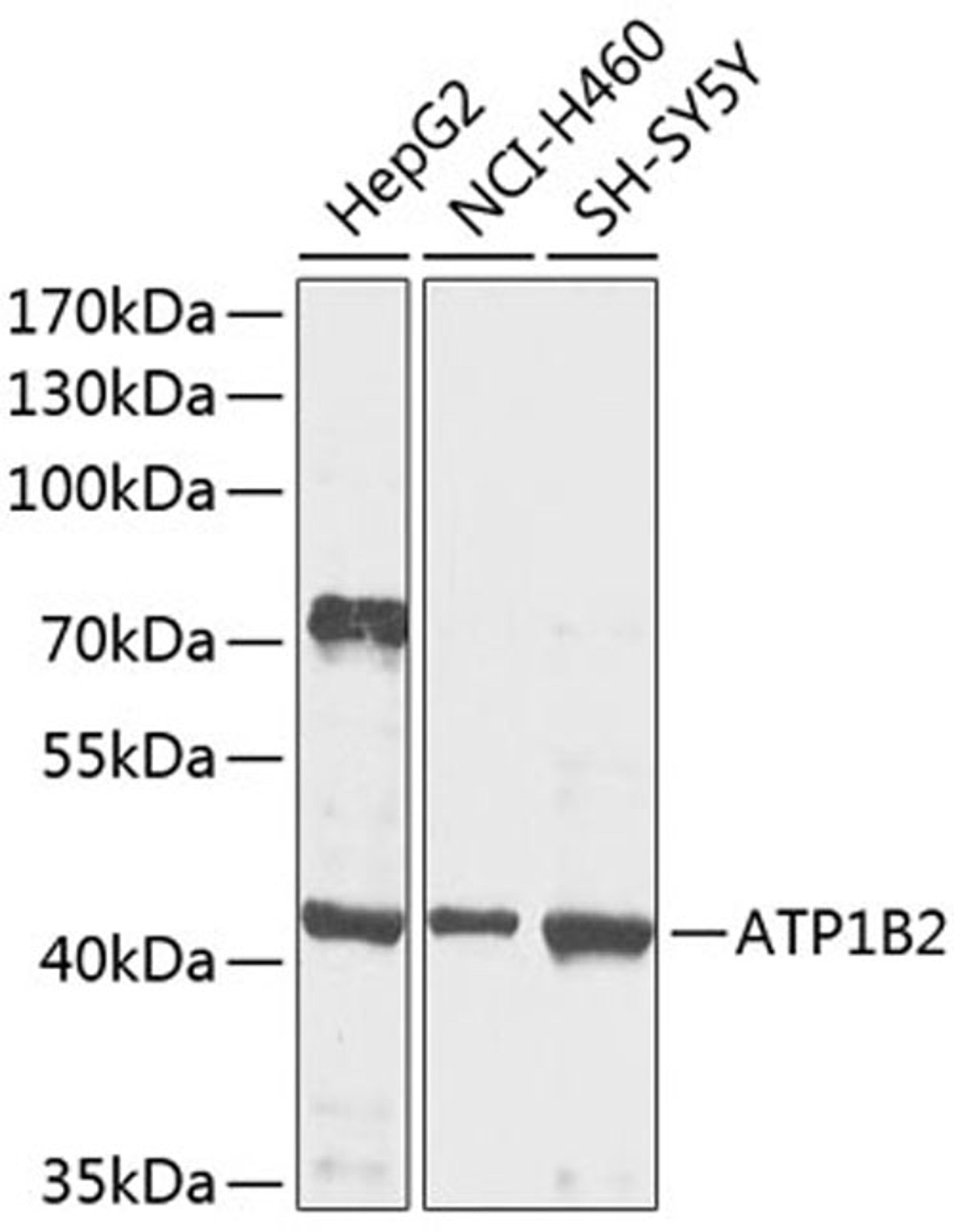 Western blot - ATP1B2 antibody (A9928)