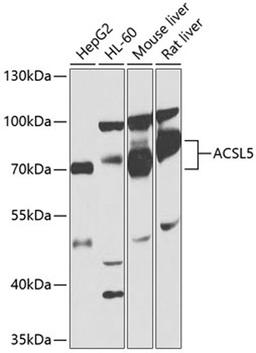 Western blot - ACSL5 antibody (A1270)