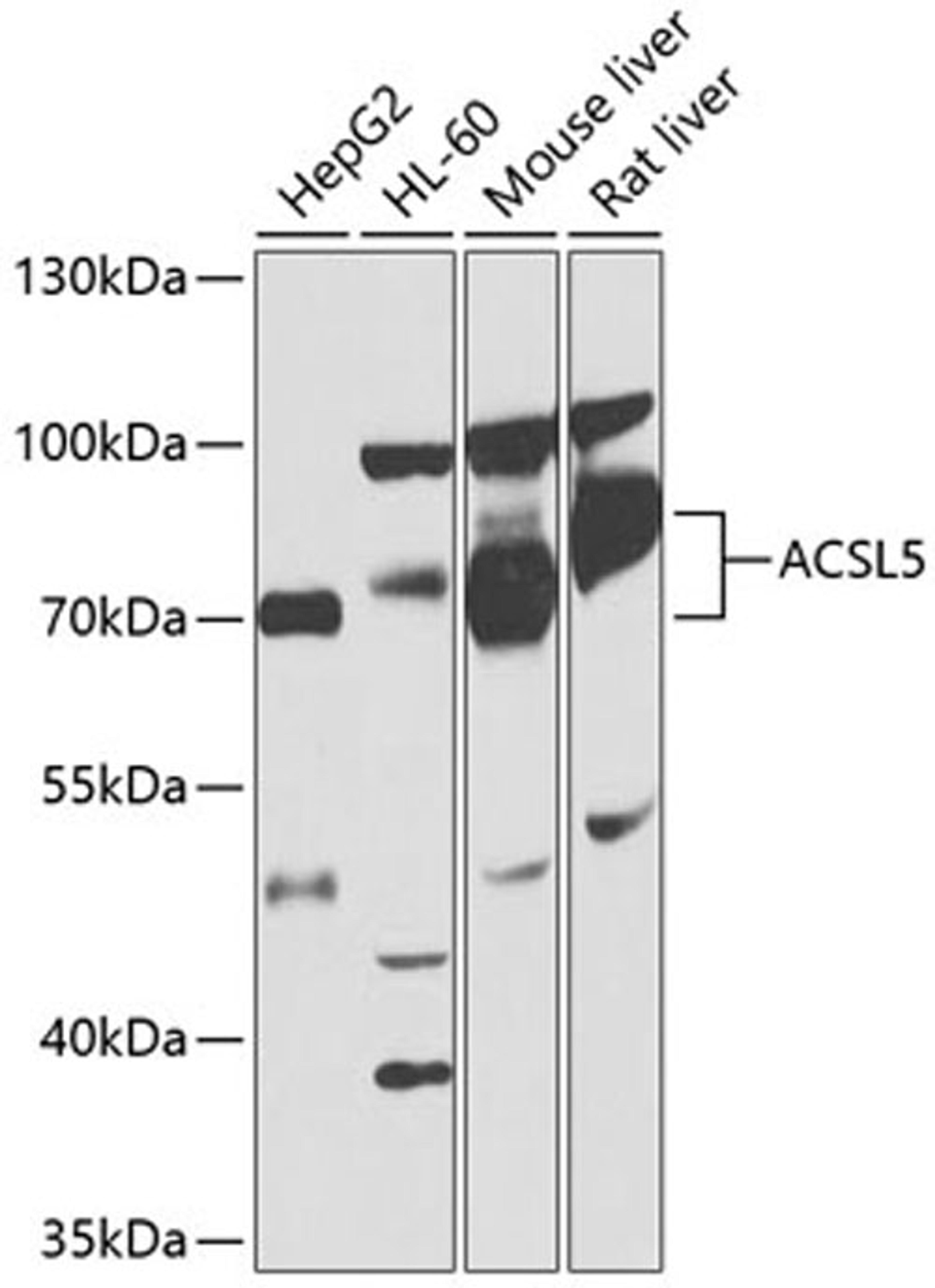 Western blot - ACSL5 antibody (A1270)