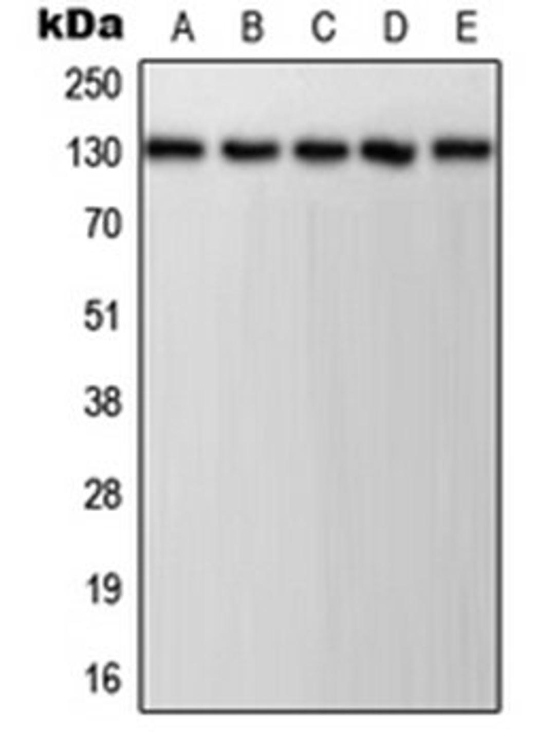 Western blot analysis of HeLa (Lane 1), Jurkat (Lane 2), K562 (Lane 3), NIH3T3 (Lane 4), PC12 (Lane 5) whole cell lysates using PECAM1 antibody