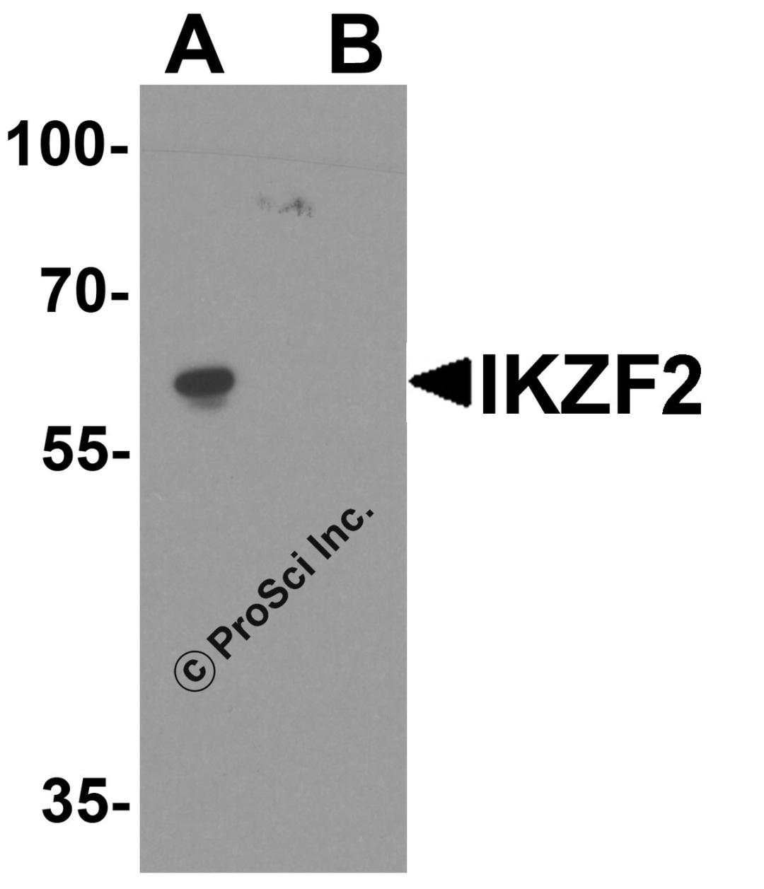 Western blot analysis of IKZF2 in EL4 cell lysate with IKZF2 antibody at 1 μg/ml in (A) the absence and (B) the presence of blocking peptide.