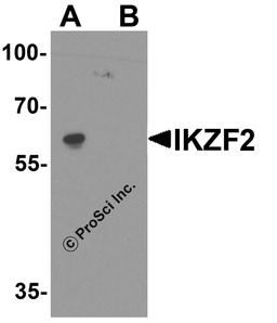 Western blot analysis of IKZF2 in EL4 cell lysate with IKZF2 antibody at 1 μg/ml in (A) the absence and (B) the presence of blocking peptide.