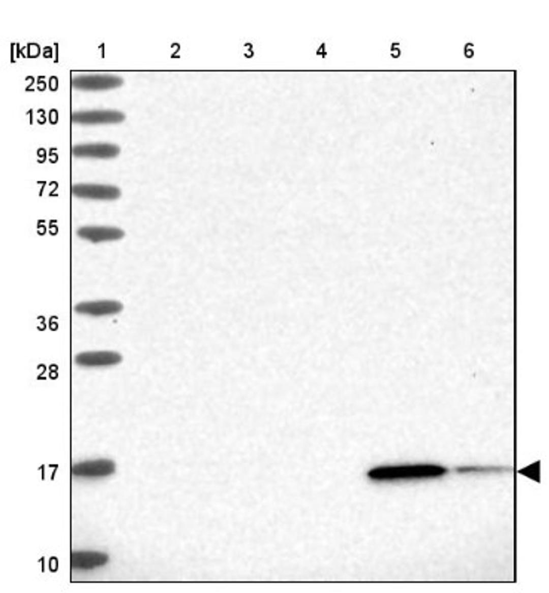 Western Blot: RBP5 Antibody [NBP2-32643] - Lane 1: Marker [kDa] 250, 130, 95, 72, 55, 36, 28, 17, 10<br/>Lane 2: Human cell line RT-4<br/>Lane 3: Human cell line U-251MG sp<br/>Lane 4: Human plasma (IgG/HSA depleted)<br/>Lane 5: Human liver tissue<br/>Lane 6: Human tonsil tissue