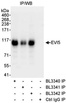 Detection of human EVI5 by western blot of immunoprecipitates.