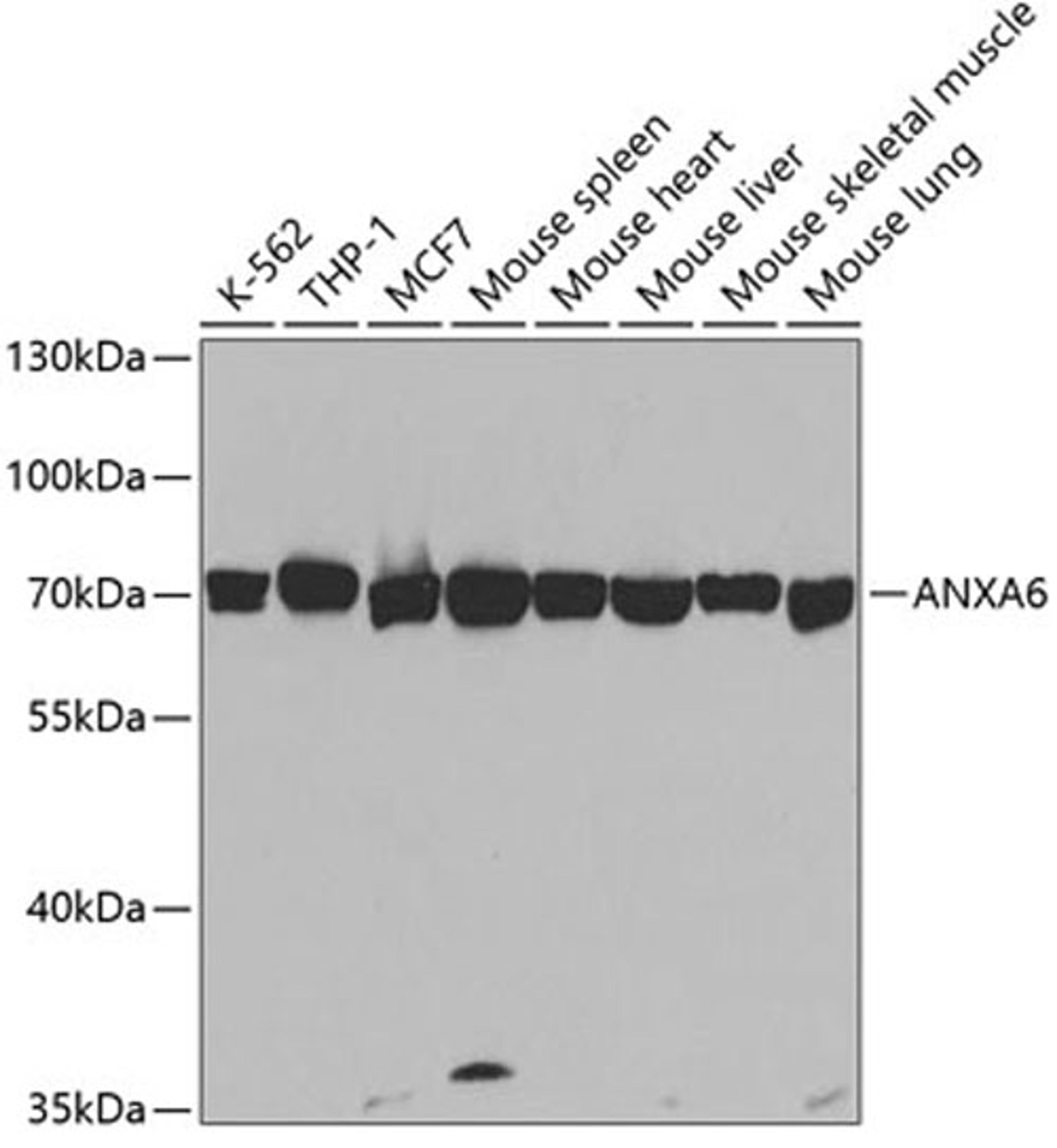 Western blot - ANXA6 antibody (A5390)