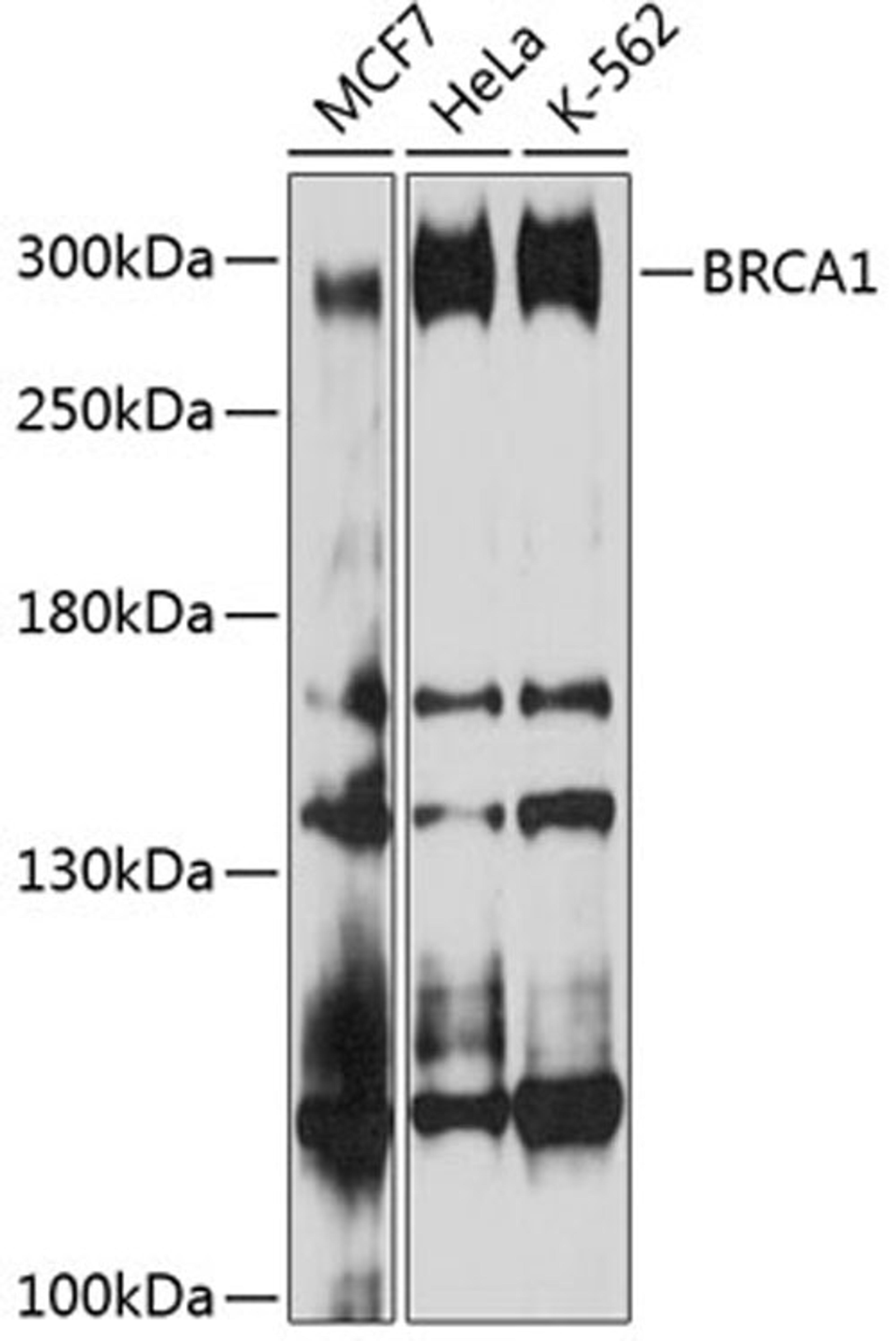 Western blot - BRCA1 antibody (A11318)