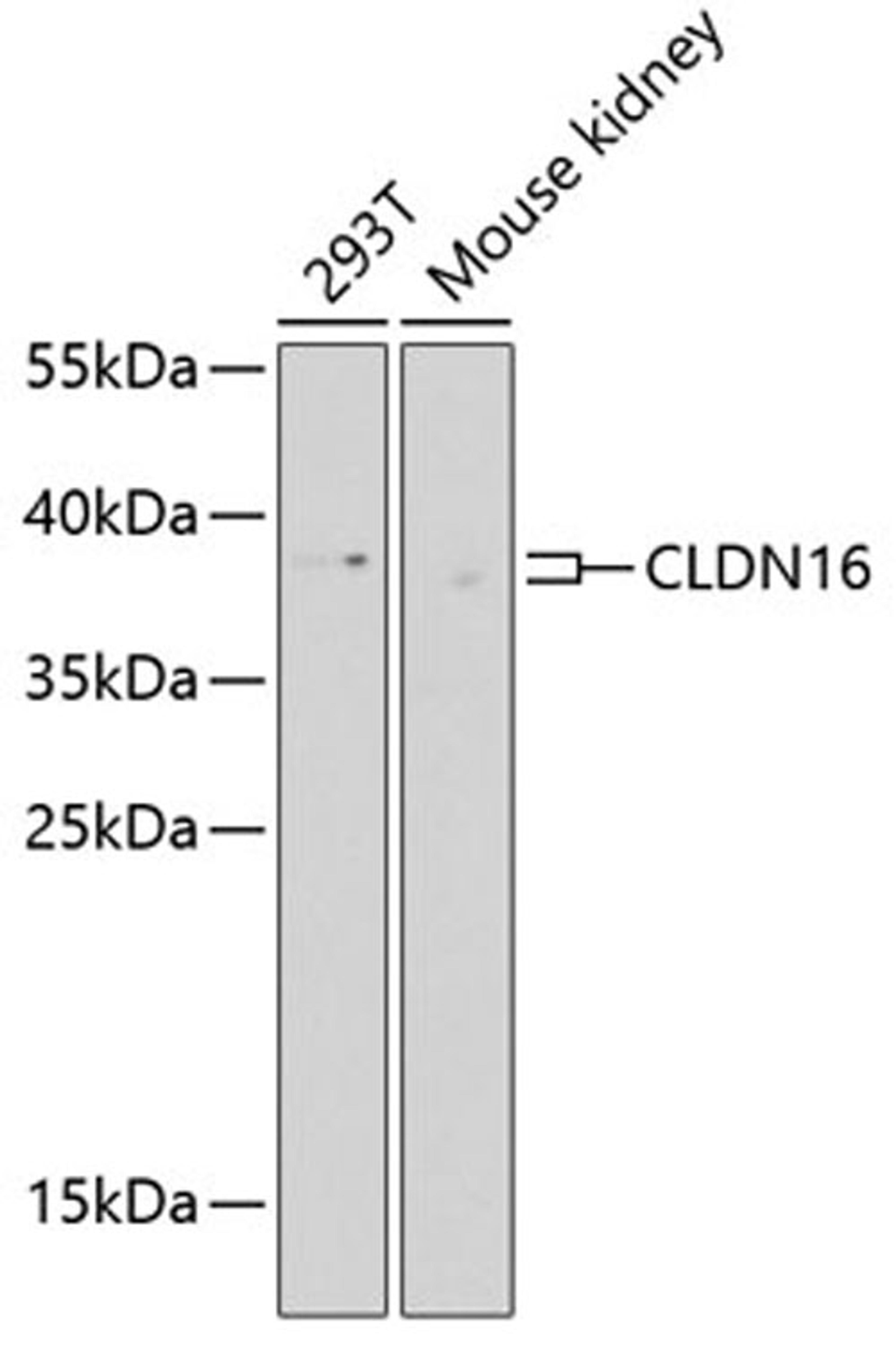 Western blot - CLDN16 Antibody (A9862)