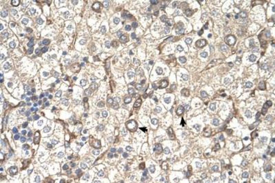 Immunohistochemistry: ST3GAL4 Antibody [NBP1-69565] - Human Liver cells.