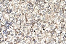 Immunohistochemistry: ST3GAL4 Antibody [NBP1-69565] - Human Liver cells.