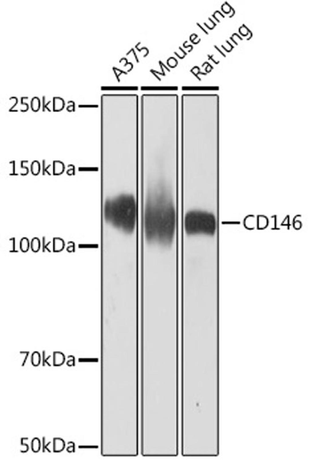 Western blot - CD146 Rabbit mAb (A9703)