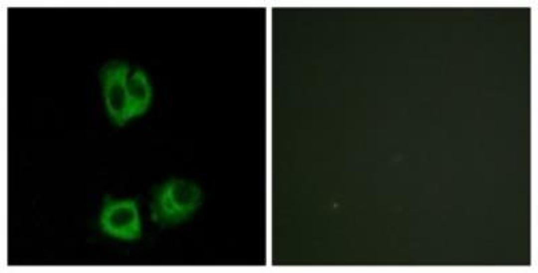 Immunocytochemistry/Immunofluorescence: Lck [p Tyr394] Antibody [NBP1-60894] - Analysis of HeLa cells. The picture on the right shows analysis after treatment with the synthesized peptide.