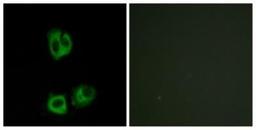 Immunocytochemistry/Immunofluorescence: Lck [p Tyr394] Antibody [NBP1-60894] - Analysis of HeLa cells. The picture on the right shows analysis after treatment with the synthesized peptide.