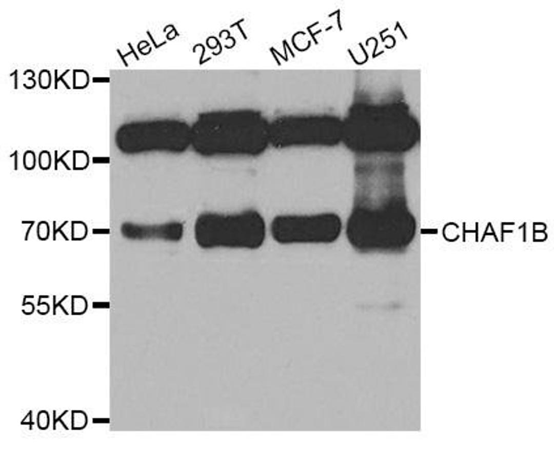 Western blot analysis of extracts of various cell lines using CHAF1B antibody