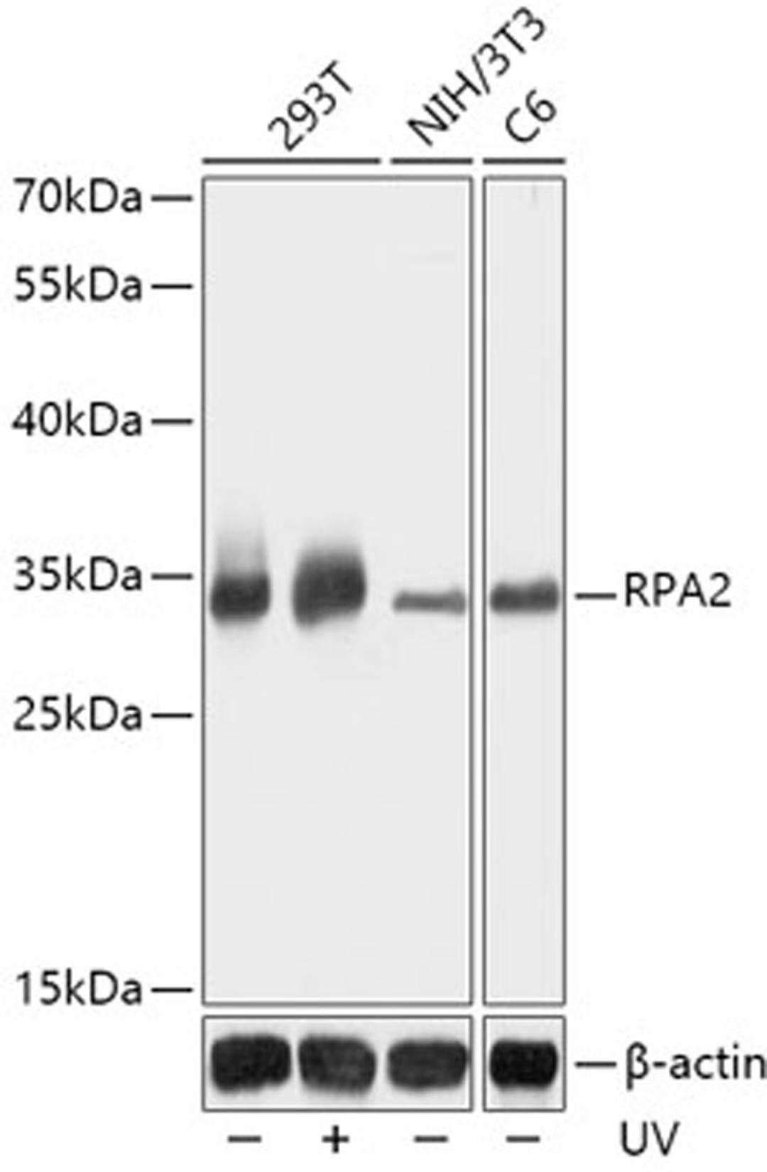 Western blot - RPA2 antibody (A2189)